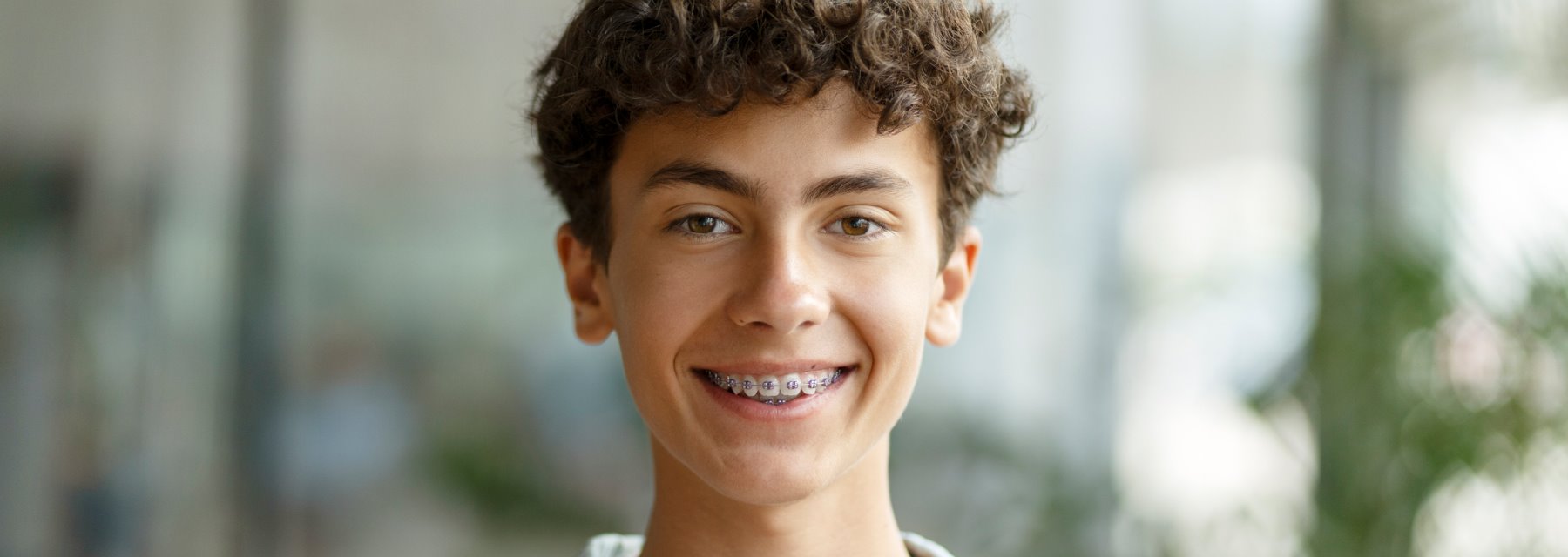 Adolescent Orthodontic Treatment in San Angelo, Tx