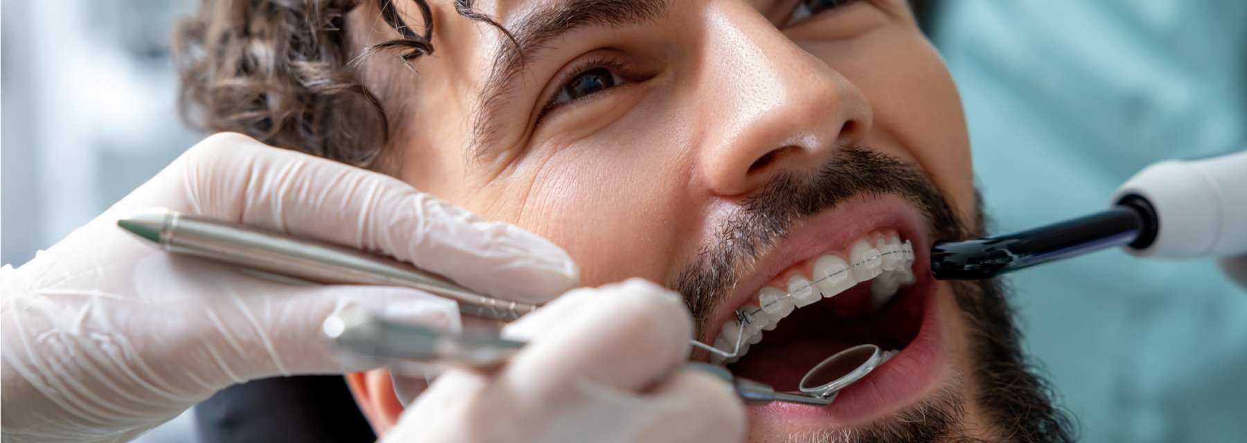 Orthodontic Emergencies in San Angelo, Tx