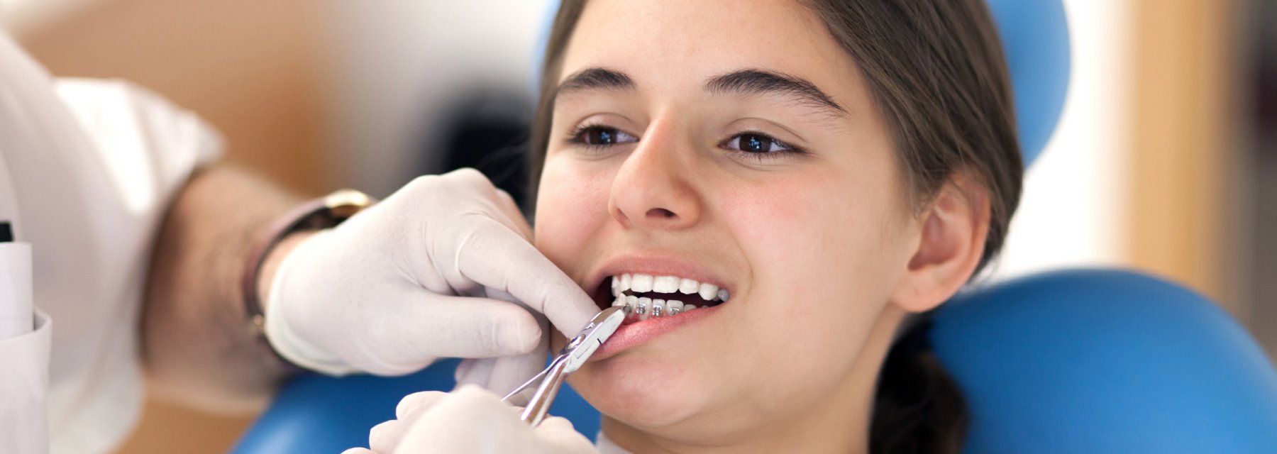 Types of Braces in San Angelo, Tx